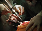 Specialized surgery